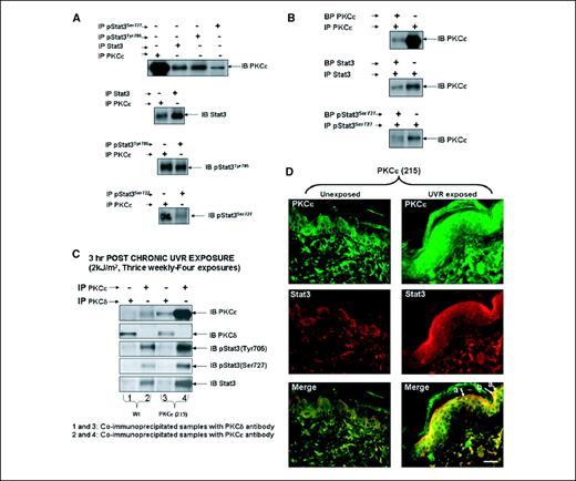 Figure 4. PKCε associates with Stat3. Wild-type and PKCε-overexpressing transgenic mice were exposed to UVR [2 kJ/m2 four times (Monday, Wednesday, Friday, and Monday)]. Mice were sacrificed 1 h (A and B) or 3 h (C and D) post last UVR exposure. Epidermal protein extracts were prepared as described in the legend to Fig. 1. Twenty-five micrograms of protein were used for immunoprecipitation with the indicated antibodies. The immunoprecipitated (IP) samples were analyzed by immunoblot (IB) with the indicated antibodies. The indicated antibodies were pretreated overnight with the blocking peptide (1 μg/mL) at 4°C before the immunoprecipitation of the epidermal extract (B). For colocalization of PKCε and Stat3 in UVR-exposed, PKCε-overexpressing mouse epidermis (D), PKCε (215) mice were exposed to UVR as described in the legend to Fig. 1. Mice were sacrificed at 3 h after the fourth UV exposure. Double immunofluorescence for PKCε and Stat3 was done as described in Materials and Methods. Immunofluorescence images of the representative localization of PKCε foci (green; top) and Stat3 foci (red; middle) following 3 h post chronic UVR exposure. Merging the images revealed that UVR-induced PKCε foci colocalized with Stat3 foci (white arrows; yellow foci; bottom). Bar, 25 μm (×20 magnification).