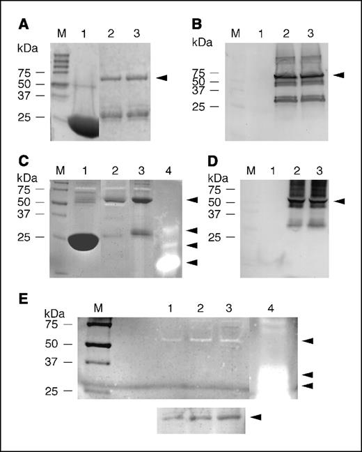 Figure 1. Results of TSP50 protein purification and zymogram gel assays. Lane M, protein molecular weight markers in kilodaltons (kDa). A, SDS-PAGE gel results. Lanes 1, 2, and 3, GST-affinity column–purified GST, the GST/TSP50 fusion protein, and its mutated counterpart GST/TSP50/T/A, respectively. Fusion proteins (solid triangle). B, a Western blot duplicate membrane where the AT-50 antibody was used to indicate the fusion proteins. C, zymogram gel results. Lanes 1, 2, 3, and 4, GST, GST/TSP50, GST/TSP50/T/A, and trypsin type IX, respectively. Enzyme activity of the fusion protein and trypsin-digested bands (solid triangles). D, a duplicate gel without the casein substrate for Western blot using the AT-50 antibody. Lane 1, GST; lanes 2 and 3, GST-TSP50 and GST/TSP50/T/A fusion protein, respectively (solid triangle). E, zymogram gel results for analysis of TSP50 isolated from MAD-MB-231 cells. Lane 1, TSP50 was purified by a benzamidine- then AT-50-affinity column. Lane 2, TSP50 was purified by an AT-50- then benzamidine-affinity column. Lane 3, TSP50 was purified solely by an AT-50-affinity column. Lane 4, trypsin type IX was used as a positive control. TSP50 enzymatic activity (upper solid triangle) and positive control (bottom solid triangles). Bottom, duplicate gel without the substrate for Western analysis. The protein bands (solid triangle) correspond to those in lanes 1, 2, and 3, respectively.