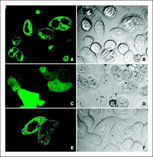 Figure 2. Cellular location of EGFP/TSP50 determined by confocal microscopy. EGFP/TSP50 is located in the ER and the cytoplasm membrane of HeLa cells. A and B, bright and fluorescent field, respectively, for HeLa cells transiently transfected by pEGFP/TSP50. C and D, bright and fluorescent field, respectively, for HeLa cells containing pEGFP-C1. E and F, bright and fluorescent field, respectively, for cells transfected with the ER-targeting plasmid pEYFP-ER, which served as an ER structure control.
