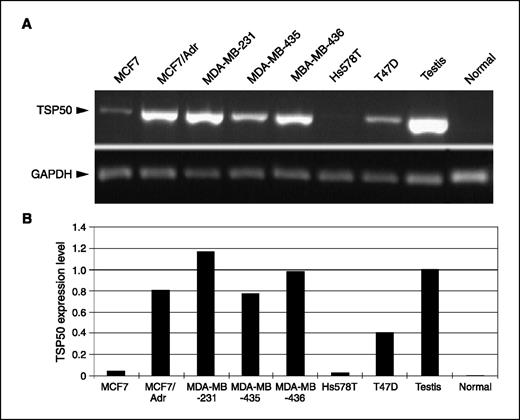 Figure 5. A, semiquantitative RT-PCR for TSP50 expression levels in a breast cancer cell line panel. The name of each cell line is listed on top of the agarose gel figure. RNAs obtained from breast and testis tissues served as the negative and positive controls. GAPDH served as the quantitative control. B, the TSP50 transcript in each sample was quantitatively compared.