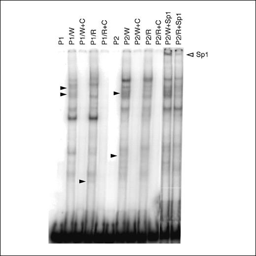 Figure 6. EMSA and super EMSA results when probes 1 and 2 were used. Lane P1, only the isotope labeled probe 1 (negative control). Lane P1/W, labeled probe 1 and MCF7 nuclear extract. Lane P1/W+C, labeled probe 1, 100 times excess of cold probe 1 and MCF7 extract. Lane P1/R, labeled probe 1 and MCF7/Adr extract; lane P1/R+C, labeled probe 1, 100 times excess of cold probe 1 and MCF7/Adr nuclear extract. Lane P2, only the isotope labeled probe 2 (negative control). Lane P2/W, isotope labeled probe 2 and MCF7 nuclear extract. Lane P2/W+C, labeled 2 probe, 100 times excess cold probe 2 and MCF7 extract. Lane P2/R, labeled probe 2 and MCF7/Adr extract; lane P2/R+C, labeled probe 2, 100 times excess of cold probe 2 and MCF7/Adr nuclear extract. P2/W+Sp1 and P2/R+Sp1 were the same as P2/W and P2/R except they contain the Sp1 antibody. For both probes: different binding patterns generated by MCF7/Adr and MCF7 nuclear extracts (solid triangles) and Sp1 complexes (hollow triangle). The reactions were loaded on a 6% non-denaturing PAGE gel.