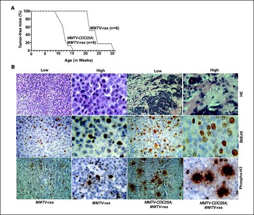 Figure 2. MMTV-CDC25A transgene cooperates with MMTV-H-ras in murine tumorigenesis. A, Kaplan-Meier tumor-free survival curves of MMTV-H-ras single transgenic mice and MMTV-H-ras; MMTV-CDC25A double transgenic mice. The median time of tumor-free survival was 147 and 85 d, respectively. Log-rank test analysis showed significant difference between the two groups (P = 0.0003). B, invasive tumors with enhanced proliferation in MMTV-H-ras; MMTV-CDC25A mice. Top, H&E-stained sections with low (×10) and high (×40) magnification. Increased cells at S and M phases in tumors are shown by immunohistochemistry using anti-BrdUrd and anti–phosphorylated histone H3 (Phospho-H3) antibodies. Mice were injected with BrdUrd at 2 h before sacrifice.