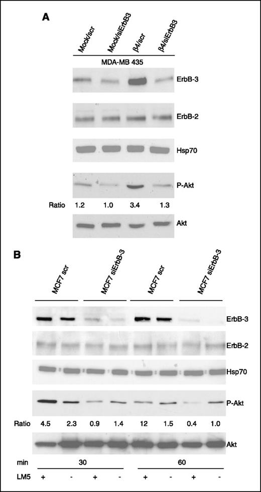 Figure 3. The α6β4 stimulation of Akt activation is dependent on ErbB-3. A, mock and α6β4-expressing MDA-MB-435 cells were transiently transfected for 48 h with either ErbB-3–specific or scrambled siRNAs. The cells were then serum starved for 24 h and extracted in detergent. Equivalent amounts of protein were separated by SDS-PAGE and analyzed by immunoblotting to evaluate the relative expression of ErbB-3, ErbB-2, and phospho-Akt (P-Akt). Hsp70 and Akt antibodies were used to validate equivalent loading of protein in each lane. B, MCF7 cells were transiently transfected for 48 h with either ErbB-3–specific or scrambled siRNAs and then serum starved for 24 h. Subsequently, the cells were plated on either laminin 5 (LM5) or poly-l-lysine for the indicated time. Equivalent amounts of protein were resolved by SDS-PAGE and analyzed by immunoblotting to evaluate the relative expression of ErbB-3, ErbB-2, and phospho-Akt. Hsp70 and Akt antibodies were used to validate equivalent loading of protein in each lane. The relative level of phospho-Akt to total Akt was assessed by densitometry using the NIH Image program and this ratio is provided under the phospho-Akt bands for each immunoblot.