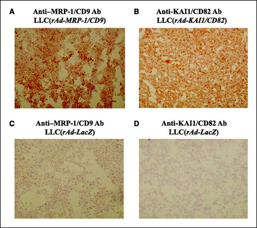 Figure 5. Immunohistochemical findings of resected primary lung tumors. Frozen specimens were used for immunohistochemical staining procedures. M31-15 and C33 mAbs were used to detect MRP-1/CD9 (A and C) and KAI1/CD82 (B and D), respectively, as described in detail in Materials and Methods. The strongest staining on the surface of tumor cells accompanied by relatively weaker cytoplasmic staining was observed in both specimens obtained from mice treated by rAd-MRP-1/CD9 (A) and rAd-KAI1/CD82 (B), indicating that intratracheal adenoviral gene deliveries were successful. Tumors obtained from mice treated by rAd-LacZ did not show significant staining for both MRP-1/CD9 (C) and KAI1/CD82 (D).