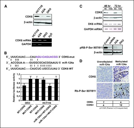Figure 3. Epigenetic silencing of miR-124a leads to CDK6 activation. A, Western blot for CDK6 in wild-type HCT-116, HCT-116 cells treated with a DNA-demethylating agent (5-aza-2′-deoxycytidine), and DKO cells. These two cell lines show a reduction in CDK6 levels. RT-PCR analyses of CDK6 mRNA do not show any change. B, miR-124a interact and interfere with the 3′-UTR of CDK6 mRNA. Top, base pairing comparison between mature miR-124a and the wild-type (WT) or mutant (MUT) CDK6 putative target site. Bottom, luciferase assays of DKO (miR-124a expressor) or HCT-116 (miR-124a non-expressor) cells transfected with firefly luciferase constructs containing CDK6-WT or CDK-MUT. In the case of HCT-116 cells, the results of miR-124a cotransfection are also shown. Normalized luciferase activities are represented. C, top, Western blots for CDK6 in original HCT-116 cells and HCT-116 cells transfected with miR-124a precursor, showing CDK6 down-regulation. RT-PCR analyses of CDK6 mRNA do not show any change. Bottom, Western blot for phosphorylated Rb shows that HCT-116 cells transfected with the miR-124a precursor, HCT-116 cells treated with the DNA-demethylating agent, and DKO cells are hypophosphorylated at the two Rb sites mediated by CDK6. D, immunohistochemistry of CDK6 and phosphorylated Rb in human primary lung tumors. Left, miR-124a unmethylated tumor showing loss of CDK6 expression and hypophosphorylated Rb; right, miR-124a methylated tumor showing strong CDK6 staining and phosphorylated Rb. Those tumors with a high percentage of tumor cells (>50%) with positive nuclear staining were considered to have strong CDK6 expression. Bottom, table representing the distribution of cases. GAPDH, glyceraldehyde-3-phosphate dehydrogenase.