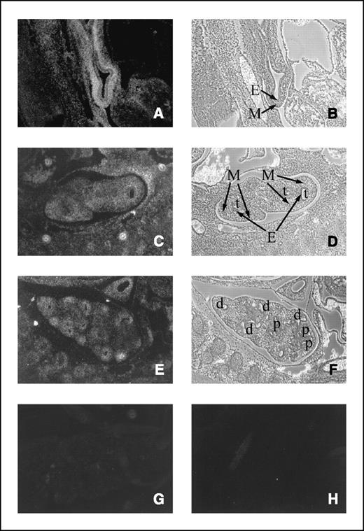 Figure 1. In situ hybridization analysis for Hmga2 in developing mouse lung. Photomicrographs of sections of 11.5 (A, B, and H), 12.5 (C and D), 13.5 (E and F), and 14.5 d post coitum (dpc; G) in the developing lung. Sections were hybridized with the antisense (A–G) or sense (H) Hmga2 riboprobe. A, C, E, G, and H, dark-field; B, D, and F, phase-contrast views of (A), (C), and (E), respectively. E, endoderm; M, mesenchyme; t, tubule; d, distal tubules (identified by their characteristic cuboidal epithelium); p, proximal tubules (defined by their columnar epithelium). Magnification, ×100.