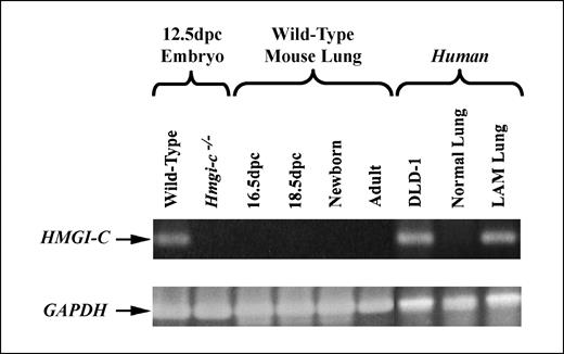 Figure 2. Expression pattern of HMGA2 in mouse and human lung. Total embryonic RNAs extracted from 12.5 d post coitum wild-type or Hmga2−/− embryos were used as positive and negative controls for Hmga2 expression (259-bp product in mice). RNA extracted from the lungs of 16.5 and 18.5 d post coitum embryos, newborn, and adult wild-type mice showed no Hmga2 expression. The human colorectal adenocarcinoma cell line DLD-1 serves as a positive reverse transcription-PCR control for HMGA2 expression in human RNA (ref. 11; 262-bp product in humans). HMGA2 expression was undetectable in normal adult human lung but was detected in RNA isolated from LAM lung tissue. To verify the integrity of the RNA, all samples were tested for GAPDH (436-bp band; bottom).