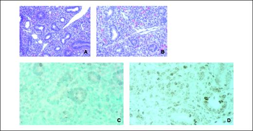 Figure 6. Increased proliferation in the lung of HMGA2 transgenic mice. H&E staining of sections from a 14-d embryonic lung from wild-type (A) and HMGA2 transgenic (B) mice. Ki67 staining of wild-type (C) and transgenic (D) lungs reveals increased proliferation in the mesenchymal cells of the transgenic lung (D). Magnification, ×375 (A and B); ×500 (C and D).