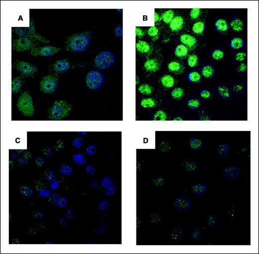 Figure 3. Soy isoflavones decrease APE1/Ref-1 nuclear protein expression and inhibit APE1/Ref-1 radiation-induced increase by confocal microscopy analysis. PC-3 cells were pretreated with 30 μmol/L soy isoflavones for 48 h followed by 3 Gy radiation. At 1 h after radiation, cells were processed for APE1/Ref-1 immunostaining and examined by confocal microscopy. A, control cells showing uniform nuclear and cytoplasmic APE1/Ref-1 staining. B, radiation-treated cells exhibiting intense nuclear APE1/Ref-1 staining. C and D, cells treated with soy isoflavones alone (C) or combined with radiation (D), showing significant decrease in nuclear APE1/Ref-1 staining.