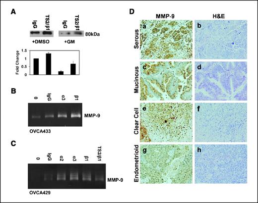 Figure 3. MMP-9 expression in ovarian cancer cell lines and tumor samples. A, OVCA433 cells were preincubated with GM6001 (50 μmol/L) or DMSO before treatment with either control IgG or TS2/β1 antibody immobilized on latex beads for 20 h. The 80-kDa E-cadherin ectodomain was immunoprecipitated from the conditioned media as described in Materials and Methods. Immunoprecipitates were electrophoresed on a 9% SDS-PAGE gel, transferred to a PVDF membrane, and immunoblotted with anti-E-cadherin (HECD-1; 1:4,000) followed by peroxidase-conjugated secondary antibody (1:5,000) and ECL detection. Representative Western blot and densitometric quantification of the 80-kDa Ectodomain. Results were normalized against the densitometric reading for cells treated with control IgG beads (lane 1) and represent three independent experiments. B, OVCA433 cells were treated with control IgG, anti-integrin α3, or anti-integrin β1 immobilized to latex beads for 40 h. C, OVCA429 cells were treated with control IgG, anti-integrin α2, anti-integrin α3, anti-integrin β1, or anti-integrin β1/TS2 immobilized to latex beads for 36 h. B and C, the resulting conditioned media (30 μL) were analyzed for MMP-9 expression using gelatin zymography. Under serum-free conditions, the proenzyme form of MMP-9 is detected. D, tumor samples were stained with antibodies to MMP-9 (1:200; a, c, e, and g) or H&E (b, d, f, and h) as described in Materials and Methods. a and b, serous carcinoma; c and d, mucinous carcinoma; e and f, clear cell carcinoma; g and h, endometrioid carcinoma.