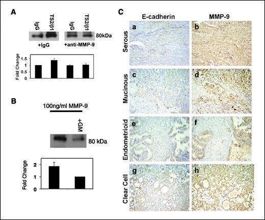 Figure 4. MMP-9 promotes integrin-mediated E-cadherin ectodomain shedding. A, OVCA433 cells were preincubated with anti-MMP-9 (10 μg/mL) or control IgG before treatment with either control IgG or TS2/β1 antibody immobilized on latex beads for 20 h. The 80-kDa E-cadherin ectodomain was immunoprecipitated from the conditioned media as described in Materials and Methods. Immunoprecipitates were electrophoresed on a 9% SDS-PAGE gel, transferred to a PVDF membrane, and immunoblotted with anti-E-cadherin (HECD-1; 1:4,000) followed by peroxidase-conjugated secondary antibody (1:5,000) and ECL detection. Representative Western blot and densitometric quantification of the 80-kDa ectodomain. Results were normalized against the densitometric reading for cells treated with control IgG beads (lane 1) and represent three independent experiments. B, OVCA433 cells were preincubated with GM6001 (50 μmol/L) or DMSO before treatment with recombinant activated MMP-9 (100 ng/mL) for 24 h. The 80-kDa E-cadherin ectodomain was immunoprecipitated from the conditioned media as described in Materials and Methods. Immunoprecipitates were electrophoresed on a 9% SDS-PAGE gel, transferred to a PVDF membrane, and immunoblotted with anti-E-cadherin (HECD-1; 1:4,000) followed by peroxidase-conjugated secondary antibody (1:5,000) and ECL detection. Representative Western blot and densitometric quantification of the 80-kDa ectodomain. Results were normalized against the densitometric reading for cells treated with MMP-9 and GM6001 (GM; lane 2) and represent two independent experiments. C, serial sections of ovarian tumor samples were stained with antibodies to E-cadherin (1:200; a, c, e, and g) or MMP-9 (1:200; b, d, f, and h) as described in Materials and Methods. a and b, serous carcinoma; c and d, mucinous carcinoma; e and f, endometrioid carcinoma; g and h, clear cell carcinoma.