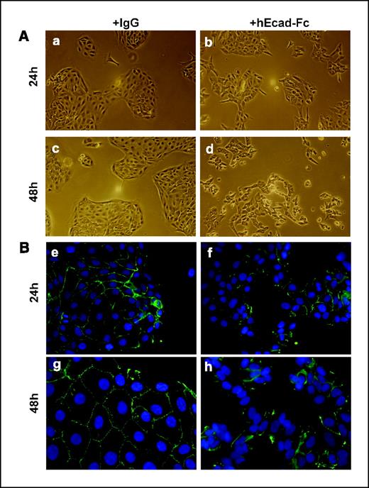 Figure 5. The shed E-cadherin ectodomain promotes cell junction disruption and cell dissemination. OVCA433 cells were plated on glass coverslips at ∼60% confluence. The next day, cells were incubated in serum-free media overnight before treatment with hEcad-Fc (12 μg/mL) or control IgG for 24 and 48 h. A, phase-contrast images of cells were taken at 24 h (a and b) and 48 h (c and d). Magnification, ×10. B, cells were then processed for immunofluorescence using anti-cytoplasmic E-cadherin (1:300 dilution) and FITC-conjugated IgG, as described in Materials and Methods, at 24 h (e and f) and 48 h (g and h). Magnification, ×40.