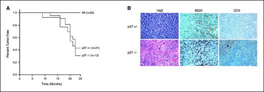 Figure 5. Tumorigenesis in mice deficient for p37Ing1. A, Kaplan-Meier survival curves of cohorts of Wt, p37Ing1-heterozygous, or p37Ing1-null mice. Mice that were either moribund or reached 22 mo of age were sacrificed for necropsy and fixed in 10% phosphate-buffered formalin. The rate of tumor incidence between Wt and either p37Ing1-heterozygous or p37Ing1-null mice is statistically significant (P < 0.005 or P < 0.05, respectively). B, tumors arising in mice were paraffin embedded and H&E stained for pathologic analysis. Tumor sections were also stained with either B220 or CD3 antibodies to determine tissue of tumor origin.