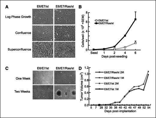 Figure 2. Expression of mutant K-Ras(12D) promotes growth transformation of E6/E7/st cells. A, mutant K-Ras causes loss of density-dependent inhibition of growth. Cell and culture morphology of E6/E7/st and E6/E7/Ras/st cells were monitored at the indicated cell densities. B, K-Ras accelerates E6/E7/st anchorage-dependent growth. Cells were seeded onto plastic to evaluate the rate of proliferation and saturation density. Points, mean of triplicate counts; bars, SE. C, K-Ras promotes anchorage-independent growth. Cells were suspended in soft agar to evaluate anchorage-independent growth potential over 21 d. D, K-Ras causes tumorigenic transformation of E6/E7/st cells. E6/E7/Ras/st cells [1 × 106 (1M) or 2 × 106 (2M)] were implanted s.c. into nude mice (n = 3–4 per group) and monitored for tumor formation for up to 54 d.