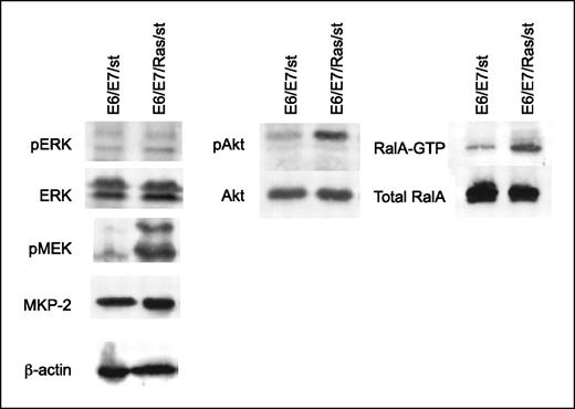 Figure 3. Ras activation of effector signaling pathways in E6/E7/st cells. Serum-starved whole-cell lysates were separated by SDS-PAGE, and Western blot analyses for the phosphorylated and activated forms of ERK1 and ERK2, MEK1 and MEK2, and Akt were done. Pull-down analysis was done to determine the level of activated RalA-GTP. Blot analyses were also done to determine total MEK1/2, ERK1/2, Akt, RalA, and MKP-2 protein expression, with blot analyses for β-actin to verify equivalent total protein for each cell line. Data are representative of one to three independent experiments.