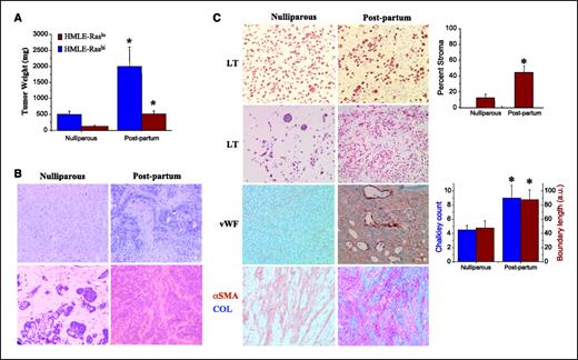 Figure 1. Human breast cancer growth is promoted following pregnancy. A, weight at harvest of HMLE-Raslo () and HMLE-Rashi () tumors that formed in either female NOD/SCID mice injected orthotopically following pregnancy (postpartum) or in age-matched nulliparous mice. B, histologic analysis of HMLE-Rashi and HMLE-Raslo tumors arising in the mammary gland postpartum or in age-matched nulliparous mice. Note the viable benign HMLE-Raslo cells in the nulliparous mice compared with the stromalized invasive tumors in postpartum mice. C, immunohistochemical characterization and quantification of stromalization in HMLE-Rashi and HMLE-Raslo tumors in postpartum or nulliparous mice. Tumor sections were stained with antibodies that label HMLE-Rashi or HMLE-Raslo cells (LT) or mouse stromal cells [vWF, αSMA, and stained using Masson's Trichrome (COL)]. Percent stroma in HMLE-Rashi tumors was calculated by counting the fraction of number of LT-negative cells per section in tumors that developed in the mammary glands of either nulliparous or postpartum mice. Quantification of the microvasculature in HMLE-Rashi tumors was done using Merz straight line interrupted () and Chalkley counts () on hotspot regions of vWF-stained tumor sections from nulliparous or postpartum mice. Desmoplastic stroma in HMLE-Raslo tumors that formed in postpartum mice was characterized by the presence of SMA-positive myofibroblasts and Masson's trichrome–stained collagen. Columns, mean; bars, SE. *, statistical significance determined as described in Materials and Methods.