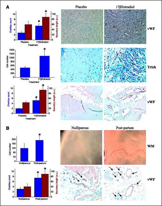 Figure 3. Systemic effects of pregnancy and estrogen increase systemic angiogenesis and stromalization. A, increased tumor angiogenesis in response to estrogen. Quantification of vWF-stained sections of PC3 tumors that developed in mice treated with placebo or 17β-estradiol pellets. Estrogen increases angiogenesis and stromalization in the absence of tumor growth. Quantification of stromalization was done by counting the number of red nuclei in trichrome-stained sections of Matrigel plugs harvested from mice treated with placebo or 17β-estradiol pellets. Representative Masson's trichrome–stained sections of Matrigel plugs from placebo- or 17β-estradiol–treated mice. Quantification of angiogenesis and microvasculature by Merz straight line interrupted () and Chalkley counts () on hotspot regions of vWF-stained sections of Matrigel plugs from placebo- or 17β-estradiol–treated mice. Representative vWF immunohistochemistry–stained sections of Matrigel plugs from placebo- or 17β-estradiol–treated mice. B, physiologic effects following pregnancy increase systemic angiogenesis and stromalization in the absence of tumor growth. Matrigel plugs from nulliparous or postpartum mice were quantified for stromalization as described (Materials and Methods). White-light micrographs of Matrigel plugs isolated from nulliparous or postpartum mice. Large blood vessel recruitment is evident in plugs from postpartum mice. Quantification of angiogenesis in Matrigel plugs following pregnancy. Microvasculature was quantified using Merz straight line interrupted () and Chalkley counts () on hotspot regions of vWF-stained Matrigel plugs from nulliparous or postpartum mice. Representative vWF-stained sections of Matrigel plugs from nulliparous or postpartum mice. Columns, mean; bars, SE. *, statistical significance determined as described in Materials and Methods.