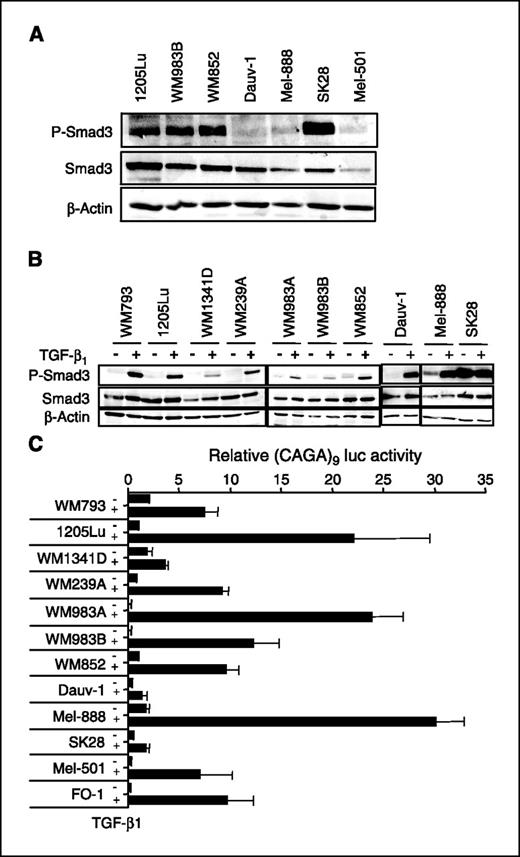 Figure 1. A, total protein extracts (60 μg) from unstimulated cultured melanoma cell lines were analyzed by Western blotting for phospho-Smad3 content. An anti–β-actin antibody was used for normalization. B, subconfluent melanoma cell cultures were incubated for 6 h in medium containing 1% serum. TGF-β1 (10 ng/mL) was added to the cultures 20 min before cell lysis for Western analysis (30 μg/lane) with specific antibodies directed against phospho-Smad3, Smad3, or β-actin. C, subconfluent melanoma cell cultures were transfected with 0.4 μg (CAGA)9-luc vector together with 0.2 μg pRL-TK Renilla luciferase expression vector. Four hours post-transfection, cultures were left untreated or stimulated with TGF-β (10 ng/mL). Luciferase activities were measured in cell extracts 16 h post-transfection. Columns, mean of three independent experiments; bars, SE.