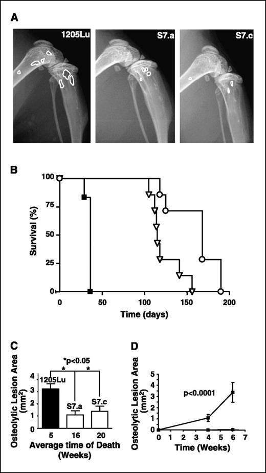 Figure 3. A, representative X-ray radiography of the hind limbs of mice, 5 wks (parental, n = 6) or 14 wks (clones S7.a and S7.b, seven mice each) post-tumor cell inoculation. Osteolytic lesions are highlighted with white lines. Note the dramatic difference in both size and number of lesions generated by parental 1205Lu cells versus Smad7-overexpressing clones. B, survival of mice bearing S7.a (▽) and S7.c (○) tumors was significantly longer than that of mice bearing parental 1205Lu cells (▴). C, osteolytic lesion area (mm2) on radiographs was measured by computerized image analysis of forelimbs and hind limbs at the time of death: 5 wks postinoculation for parental 1205Lu cells, 16 and 20 wks postinoculation for S7.a and S7.c clones, respectively. Columns, mean (n = 7); bars, SE. D, osteolytic lesion area (mm2) on radiographs was measured by computerized image analysis of forelimbs and hind limbs at 4 and 6 wks postinoculation for both pcDNA transfected 1205Lu cells (n = 11; ▪) and clones overexpressing Smad7 (12 mice for each clone; ▴ and ▾). Points, mean; bars, SE. Note that lesion area was so small in both Smad7-overexpressing 1205Lu-bearing mice that the data lines are indistinguishable from the X axis.