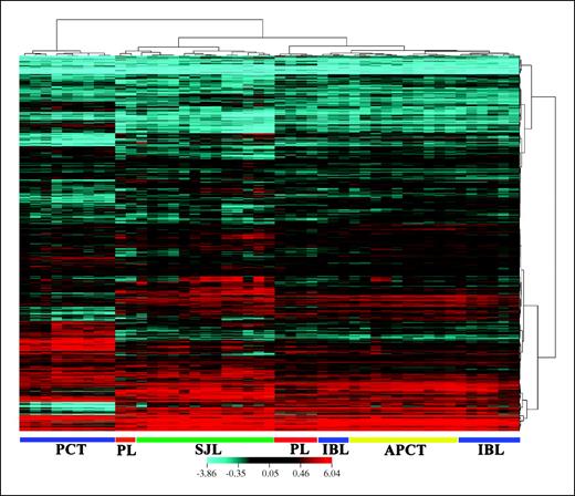 Figure 3. Relations of immunoblastic lymphomas and plasma cell–related neoplasms as determined by gene expression profiling, hierarchical clustering of histologically defined cases, and gene expression. Dendrogram at the top, the samples studied and their relationships based on similarities in gene expression. Dendrogram at the right, the expression patterns of genes across all samples with intensities depicted according to the color scale (bottom). The bars under the heat map are color coded according to the histologic classification of each tumor sample. PCT, plasmacytic plasmacytoma; PL, plasmacytoid lymphoma; SJL, SJL lymphoma; APCT, anaplastic and plasmablastic PCT; IBL, immunoblastic lymphoma.
