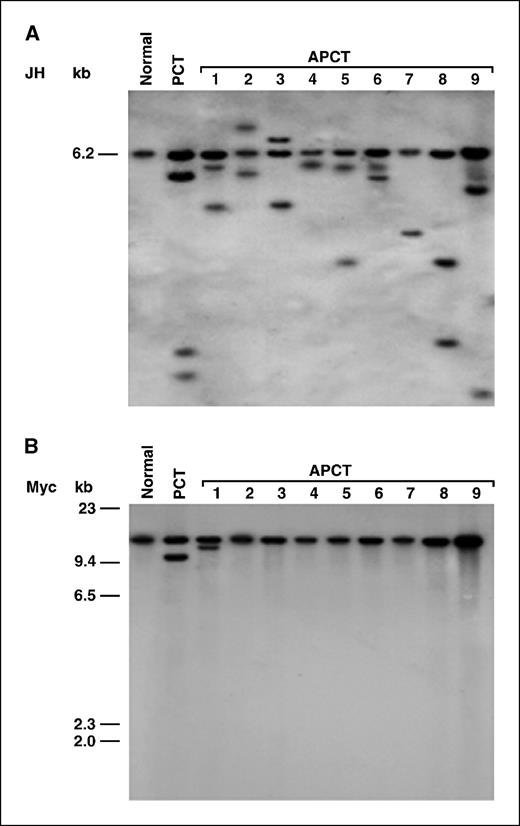 Figure 4. Organization of IgH and Myc loci by Southern blot analysis. DNA from normal spleen (Normal), a plasmacytic plasmacytoma (PCT), and nine cases of plasmablastic and anaplastic plasmacytomas (1–9) were digested with appropriate enzymes and hybridized to an IgH JH probe (A) or a Myc exon 2 probe (B).