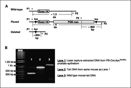 Figure 1. Elimination of Apc by Cre-lox recombination. A, schematic diagram of the PCR strategy used to confirm loss of Apc in the prostatic epithelium. Three primers (P1, P2, and P3) were designed to amplify exon 14 of the Apc gene. B, PCR analysis of DNA from prostatic epithelial cells of a 3-month-old PB-Cre+;Apcflox/flox mouse isolated by laser capture microdissection confirmed the deletion of exon 14 of the Apc gene.