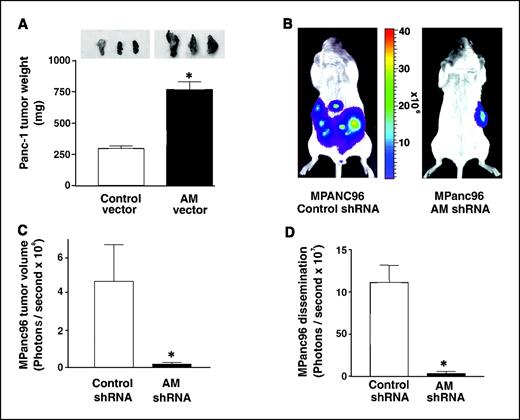 Figure 5. Adrenomedullin increases pancreatic cancer growth and metastasis in vivo. A, tumor growth of Panc-1 cells stably overexpressing adrenomedullin or control vector were analyzed. Cells (1 × 105) were inoculated orthotopically into the pancreas of 4-wk-old CB-17 SCID mice, and the mice were maintained in a clean sterile environment for another 4 wks. At the end of the experiment, the tumor was removed and weighed. Columns, mean for six animals; bars, SE. B, tumor growth of MPanc96 cells stably expressing adrenomedullin shRNA or control shRNA, as well as the luciferase gene, were assessed in CB-17 SCID mice. A representative image using pseudocolor to indicate tumor size. Bioluminescent imaging was used to estimate tumor volume and dissemination (C and D). Columns, mean for six animals; bars, SE; *, P < 0.05 versus control.