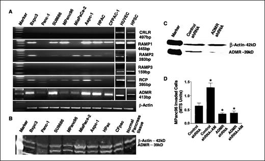 Figure 6. Different adrenomedullin receptors and binding proteins are expressed in pancreatic cancer cells and cells of the tumor microenvironment, and small interfering RNA can be used to silence ADMR in pancreatic cancer cells. A, RT-PCR expression of adrenomedullin receptors—ADMR and CRLR and its binding proteins RAMP1-3 and RCP in pancreatic cancer cell lines, in endothelial cells and in stellate cells. β-Actin served as a control. B, Western blot showing the expression of ADMR in pancreatic cancer cell lines. β-Actin served as control. C, cell lysates from MPanc96 cells stably silencing ADMR and control cells were prepared and Western blotting was conducted for ADMR. D, MPanc96 cells stably silencing ADMR and control cells were added into Biocoat Matrigel invasion upper chamber, whereas adrenomedullin (200 nmol/L) was added to the lower chamber and cells invading the lower chamber were estimated using MTS reagent. Columns, mean for three experiments; bars, SE; *, P < 0.05 versus control.