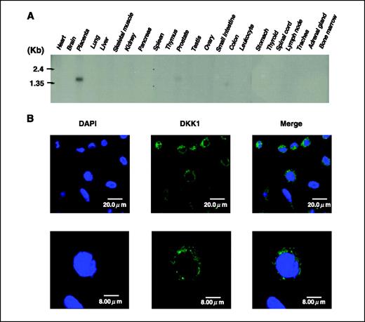 Figure 2. Expression of DKK1 in normal tissues and its subcellular localization. A, Northern blot analysis of the DKK1 transcript in 23 normal adult human tissues. A strong signal was observed in placenta and a very weak signal in prostate. B, subcellular localization of endogenous DKK1 protein in TE8 cells. DKK1 was stained at the cytoplasm of the cell with granular appearance. DAPI, 4′,6-diamidino-2-phenylindole.