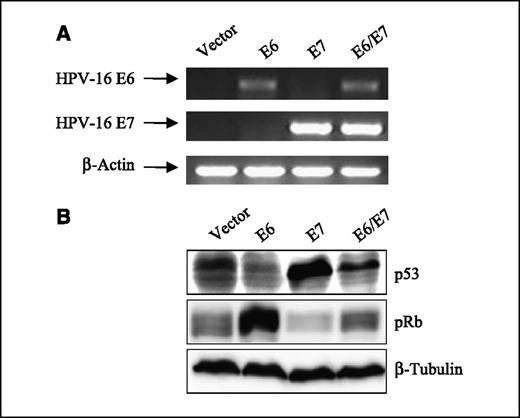 Figure 1. Expression of HPV-16 E6 and E7 in PHKs. A, total RNA isolated from PHKs expressing E6, E7, E6/E7, and vectors were subjected to RT-PCR using specific primers. The products were resolved on a 1.5% agarose gel. β-Actin was used as a control. B, E6 and E7 are functionally expressed in PHKs. Total protein extracts from PHKs expressing HPV oncogenes were resolved on SDS-PAGE gel and blotted with antibodies against p53 (Pab 1801) and pRb. β-Tubulin was used as a loading control.