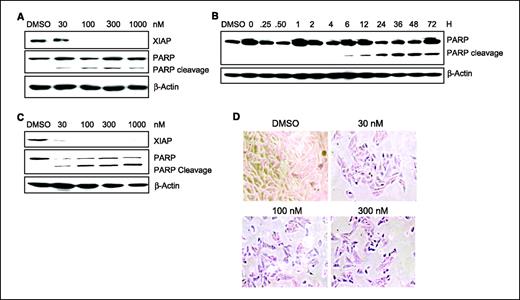Figure 4. Dasatinib induces apoptosis in bone sarcoma cell lines. A and C, dasatinib induces apoptosis in a dose-dependent manner. SaOS-2 and U-2 OS cells were treated with dasatinib for 72 h with escalating doses. Cell-free extracts were immunoblotted with antibodies specific to XIAP and PARP. B, SaOS-2 cells were treated with 100 nmol/L dasatinib in a time-dependent manner and immunoblotted with an antibody specific for PARP. D, apoptosis was further verified by TUNEL assay as described. SaOS-2 cells were plated in 12-well tissue culture plates and treated with dasatinib for 48 h in a dose-dependent manner. After completing the TUNEL assay, cells were visualized using light microscopy and photographed at ×20 magnification.