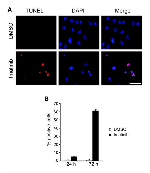 Figure 1. Imatinib induces a delayed apoptotic response. A, TUNEL staining of GIST882 cells either mock treated with DMSO or treated with 1 μmol/L imatinib for 72 h. Nuclei stained with DAPI. Bar, 10 μm. B, quantification of the percentage of TUNEL-positive GIST882 cells either treated with DMSO or 1 μmol/L imatinib for the indicated time intervals. Columns, mean of at least three independent experiments with a minimum of 100 cells counted per experiment; bars, SE.