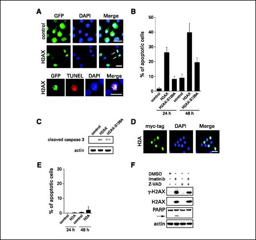 Figure 3. H2AX stimulates apoptosis in GIST cells. A, fluorescence microscopic analysis of GIST882 cells transiently transfected with empty GFP vector (control) or GFP-tagged H2AX. Nuclei stained with DAPI. Arrows, transfected cells undergoing apoptosis. Bottom, TUNEL staining of a GFP-H2AX–transfected apoptotic cell. Bars, 10 μm. B, quantification of apoptotic GIST882 cells following transient transfection with empty GFP vector (control), GFP-H2AX, or GFP-H2AX in which Ser139 has been mutated to alanine (H2AX-S139A) after 24 or 48 h. Columns, mean of at least three independent experiments with at least 100 cells counted per experiment; bars, SE. C, immunoblot analysis of GIST882 cells for cleaved caspase-3 after transient transfection with empty GFP vector (control) or GFP-tagged H2AX. D, immunofluorescence microscopic analysis of GIST882 cells transiently transfected with a myc-tagged histone H2A expression construct. Note the absence of apoptotic cells. Nuclei stained with DAPI. Bar, 10 μm. E, quantification of apoptotic GIST882 cells following transient transfection with empty vector (control) or myc-H2A after 24 or 48 h. Columns, mean of at least three independent experiments with at least 100 cells counted per experiment; bars, SE. F, immunoblot analysis of GIST882 cells for γ-H2AX, H2AX and poly-(ADP-ribose)-polymerase (PARP) after treatment with 1 μmol/L imatinib for 24 h either alone or in combination with the caspase inhibitor Z-VAD-FMK. Arrow, 85-kDa poly-(ADP-ribose)-polymerase cleavage product associated with apoptosis.