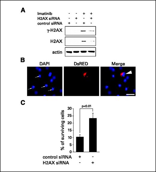 Figure 4. Depletion of H2AX attenuates the apoptotic response of GIST cells to imatinib. A, immunoblot analysis of GIST882 cells transfected with control siRNA duplexes and siRNA targeting H2AX after simultaneous treatment with 1 μmol/L imatinib for 72 h. B, fluorescence microscopic analysis of GIST882 cells transfected with siRNA duplexes targeting H2AX and simultaneous treatment with 1 μmol/L imatinib for 72 h. DsRED was used as transfection marker. Note the apoptotic fragmentation of the nuclei in the nontransfected cells and the normal nuclear morphology in the H2AX siRNA-transfected cell. Bar, 50 μm. C, quantification of surviving GIST882 cells after transfection with either control siRNA or siRNAs targeting H2AX and simultaneous treatment with 1 μmol/L imatinib for 72 h. Columns, mean of at least three independent experiments with at least 100 cells counted per experiment; bars, SE.