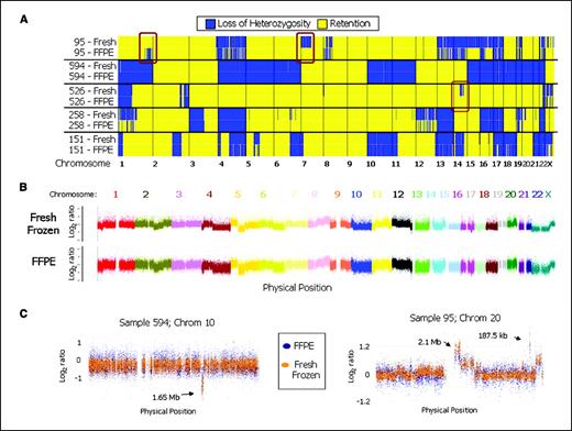 Figure 2. Genome-wide plots of LOH and copy number for fresh frozen and FFPE samples. A, genome-wide display of inferred LOH for fresh frozen and FFPE samples, including SNPs on fragments sizes ≤700 bp. Blue regions, LOH; yellow regions, retention of heterozygosity. Chromosome numbers are indicated below. Three discordant LOH predictions specific to either fresh frozen or FFPE samples were confirmed by microsatellite analysis of DNA (brown boxes, regions). B, raw single SNP log 2 ratios indicate gains and losses for fresh frozen (above) and FFPE (below) sources of sample 151 across the genome. Ratios represent copy number of tumor DNA over copy number of nontumor, non-FFPE lymphocytic DNA. Each color represents a different chromosome. SNPs were filtered for fragments ≤700 bp for the FFPE sample. C, raw single SNP log 2 ratios for fresh frozen (orange) and FFPE (blue) DNA are plotted across single chromosomes of multiple samples. SNPs were filtered for fragments ≤700 bp for FFPE data only. Highlighted copy number changes were confirmed by quantitative PCR.