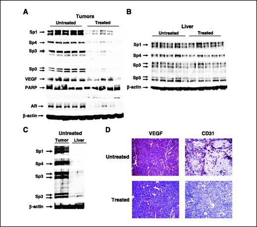 Figure 6. Sp and VEGF protein expression in tumors and liver. Whole-cell lysates from corn oil (untreated) and betulinic acid–treated tumors (A) and liver (B) were obtained from tissue from at least five rats per group and analyzed by Western blot analysis as described in Materials and Methods. C, comparative Sp protein expression in tumors and liver from corn oil (solvent)–treated animals. Tumor and liver lysates containing the same amount of protein were analyzed by electrophoresis and visualized as described in Materials and Methods. D, immunostaining for CD31 and VEGF. Fixed tumor tissue from corn oil and betulinic acid–treated mice were stained with CD31 and VEGF antibodies as described in Materials and Methods.