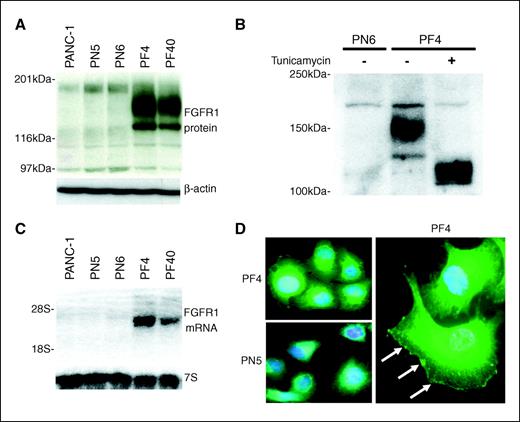 Figure 1. Characterization of FGFR1 expression and glycosylation in wild-type PANC-1 cells, control-transfected clones PN5 and PN6, and FGFR1-IIIb–expressing clones PF4 and PF40. A, top, FGFR1 immunoblot analysis; bottom, β-actin was used to document equivalent loading. B, FGFR1 glycosylation. PF4 cells were incubated in the absence (−) or presence (+) of 5 μg/mL tunicamycin for 24 h followed by FGFR1 immunoblot analysis. PN6 cells were used as negative control. C, top, Northern blot analysis of total RNA was done with a [α-32P]dCTP-labeled FGFR1 cDNA probe; bottom, a 7S cDNA probe was used as loading control. D, FGFR1 immunofluorescence. Left, top, strong intensity was found in the perinuclear area in the cytoplasm of FGFR1-IIIb–expressing PF4 cells. Right, arrows, at higher magnification, a clear membranous FGFR1 signal was detectable. Left, bottom, a moderate perinuclear signal was also observed in control-transfected PN5 clones. Nuclei were counterstained with DAPI. Original magnifications, ×300 and ×600.