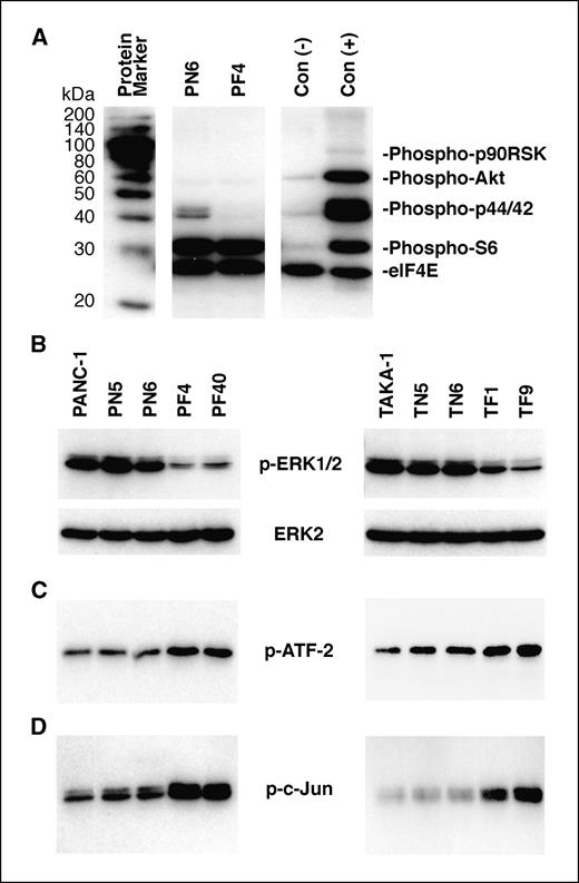 Figure 3. Effect of FGFR1-IIIb expression on tyrosine phosphorylation and kinase activity in PANC-1 and TAKA-1 cells. A, phosphorylation screening assay. PN6 and PF4 cells were subjected to immunoblotting using a cocktail of phospho-specific antibodies. eIFE4 served as loading control. Right, negative and positive controls. B, phosphorylation of p44/42 MAPK. Top, immunoblot analysis of total cell lysates from the indicated exponentially growing PANC-1 or TAKA-1 cell clones was carried out with a phospho-p44/42 MAPK antibody. After stripping, membranes were reprobed with an ERK-2 antibody recognizing active and inactive (pan) ERK-2. C, in vitro p38 MAPK activity assay. Phospho-p38 MAPK was immunoprecipitated with a phospho-p38 MAPK antibody followed by an in vitro kinase assay using ATF-2 fusion protein as substrate, which was then detected by immunoblot analysis using a phospho-ATF-2 (p-ATF-2)–specific antibody. D, in vitro SAPK/JNK activity assay. Active JNK was precipitated using resuspended c-Jun fusion protein beads followed by an in vitro kinase assay and immunoblot analysis using a phospho-c-Jun (p-c-Jun)–specific antibody.