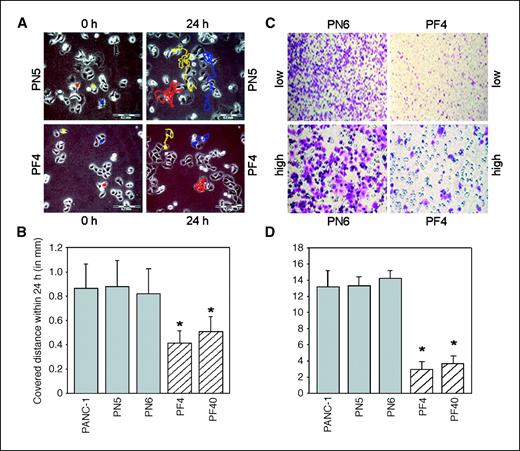Figure 4. Effect of FGFR1-IIIb expression on single-cell movement and in vitro invasion of PANC-1 cells. A, single-cell movement was monitored by time-lapse microscopy taking pictures every 10 min for 24 h. Red, yellow, and blue dots, the positions of control-transfected PN5 cells and FGFR1-IIIb–expressing PF4 cells, respectively, at the beginning (0 h). Left, red, yellow, and blue lines, tracks of the cells covered within 24 h. B, the total distance (μm in 24 h) of individual cells (n = 50) covered within 24 h was evaluated using the ImageJ 1.32 and Simple Track program. Columns, mean distances (in μm) covered within 24 h for wild-type PANC-1, control-transfected PN5 and PN6, and FGFR1-IIIb–expressing PF4 and PF40 cells; bars, SD. *, P < 0.05, compared with wild-type PANC-1, PN5, and PN6. C, Boyden chamber assay. The number of cells that moved to the lower side of the chamber within 36 h was determined. Migrated control-transfected PN6 cells and FGFR1-IIIb–expressing PF4 cells at low and high magnification. D, columns, mean number of migrated cells within 36 h of three separate experiments; bars, SD. *, P < 0.05, compared with wild-type PANC-1, PN5, and PN6.