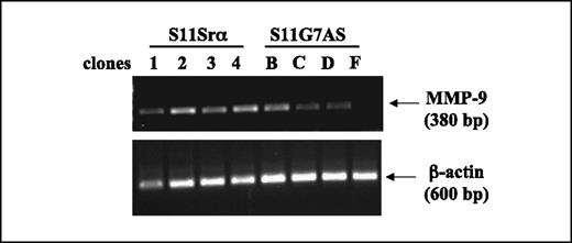 Figure 2. Inhibition of mmp-9 gene expression in lymphoma cells transfected with the antisense specific for galectin-7. Expression of mmp-9 gene in the galectin-7 antisense (S11G7AS) and control (S11Srα) transfectants was assessed by RT-PCR of RNA. β-Actin was used as loading and specificity control. Data are representative of three independent experiments.