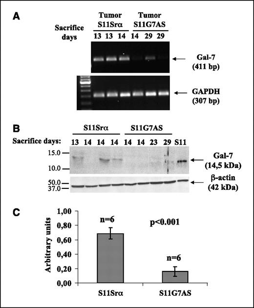 Figure 4. Expression of galectin-7 in lymphoid tumors collected from mice at necropsy. A, RT-PCR analysis of galectin-7 mRNA expression in lymphoid tumors located in the kidneys of mice injected with controls (S11Srα) or antisense transfectants (S11G7AS). β-Actin was used as loading and specificity control. B, similar analysis on tumors located in the liver carried out by Western blot using anti-galectin-7 polyclonal antibody. C, quantitative analyses of galectin-7 expression in lymphoid tumors collected at necropsy done by imaging densitometry. The histogram represents the means of independent experiments shown in (A). Statistical analysis was carried out using Student's t test for unpaired samples. Galectin-7 antisense expression significantly inhibited galectin-7 expression in kidney metastasis (P < 0.001).