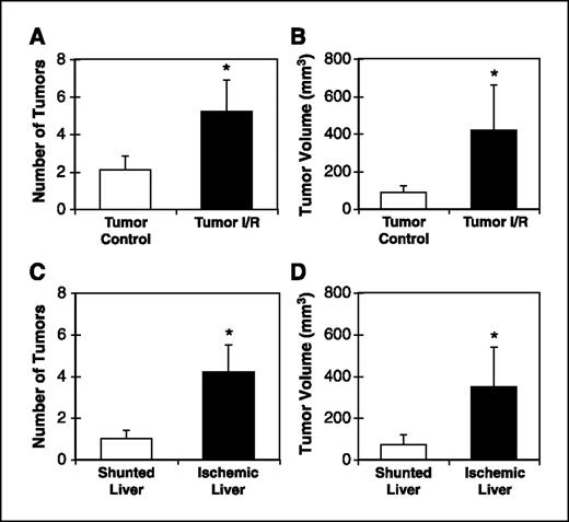 Figure 1. I/R-induced tumor growth. Twenty-eight days after surgery, animals were sacrificed and the number and volume of tumor was assessed. The number (A) and volume (B) of tumors in mice subjected to tumor injection with splenectomy (Tumor Control) is less than in those animals that were subjected to 30 min hepatic ischemia with reperfusion (Tumor I/R). Within the I/R group, the number (C) and volume (D) of tumor in shunted (right and caudate) lobes was less compared with ischemic (median and left) lobes (*P < 0.05).