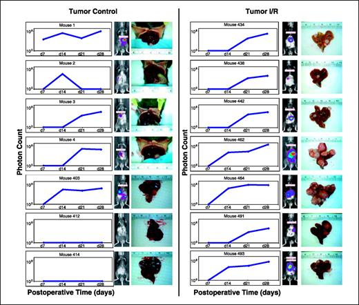 Figure 2. Nonlethal tumor tracking. Animals were monitored by bioluminescent imaging every 7 d to track tumor formation. Individual graphs of photon counts over time are displayed for tumor control mice (left column), of which 71% (five of seven) had tumor. Tumor I/R mice (right column) all developed tumor. To the right of each line graph, the bioluminescent image of individual mice and a photograph of the liver at sacrifice on postoperative day 28 are presented. Gross histologic appearance of tumor control livers at day 28 show limited tumor compared with tumor I/R livers, which consistently had significant parenchymal replacement; photon count correlated poorly with tumor burden at day 28.