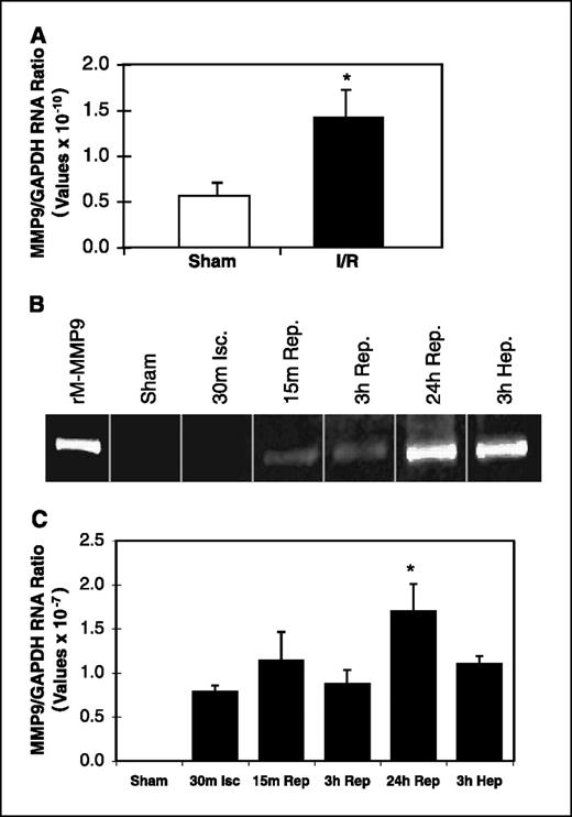Figure 3. I/R-induced tissue MMP9. Sham-operated or I/R livers harvested 7 d after surgery were first examined by quantitative real-time PCR. A, MMP9 mRNA levels were significantly higher (*P < 0.05) in the I/R group. B, gelatin zymography showed MMP9 protein levels from liver tissue in representative samples collected after sham operation (Sham); during 30 min ischemia (30m Isc); after ischemia; 15 min, 3 h, or 24 h reperfusion (15m Rep., 3h Rep., and 24h Rep.); and 3 h after hepatectomy (3h Hep, positive control; n = 3 for each condition). Recombinant mouse MMP9 (rM-MMP9) was loaded as an additional positive control. Quantitative real-time PCR done (C) on samples used previously for zymography (B) shows a significant elevation of MMP9 levels 24 h following I/R (*P < 0.05 compared with all other samples).
