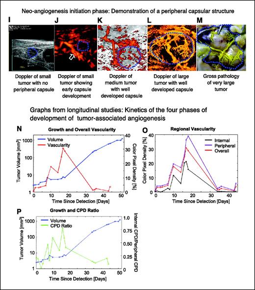 Figure 3. A–H, longitudinal study of GEM-prostate cancer using power Doppler imaging demonstrating the four distinct phases of tumor-associated angiogenesis development in a PSP-TGMAP mouse (27 weeks of age). This sequence of two-dimensional images spans a 51-day observation period beginning when the mouse was at age 19 weeks. Days 0 to 34 images are displayed in a sagittal plane; bars, 1 mm. Days 43 and 51 images are displayed in a transverse plane; bars, 2 mm. I–M, demonstration of peripheral capsular structures, which are hypothesized to be neoangiogenesis initiation sites. I, a two-dimensional Doppler image of a small tumor (1.88 mm3 volume, 1.8 mm maximum diameter) in a 60-week-old mouse that had not yet developed a peripheral capsular vascular structure. J, three-dimensional Doppler image showing a developing peripheral capsular vascular structure in a 2.1-mm3 (1.6 mm maximum diameter) tumor in a 19-week-old mouse. K, coronal view of three-dimensional Doppler and gray-scale image showing a 4-mm-diameter tumor in 27-week-old mouse that possesses well-defined capsular vascularity. L, three-dimensional Doppler image showing the peripheral capsular vascular structure of a 320-mm3 (8.0-mm-diameter) tumor in a 34-week-old mouse. M, gross pathology photograph of a very large (about 20 mm diameter) tumor in a 32-week-old mouse taken after injection of Microfil. N–P, graphs derived from the longitudinal study depicted in A–H summarize changes in tumor vascularity (measured by CPD) as a function of time (in days). N, tumor volume (blue) and vascularity measured over the entire tumor (red). O, coincident timing of vascularity peaks measured over the entire tumor (red), the peripheral region of the tumor (purple), and the internal portion of the tumor (black). P, the ratio of internal CPD to peripheral CPD (green) peaks just before the tumor volume (blue) enters its rapid growth phase.