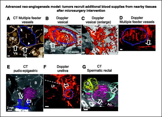 Figure 5. Examples of abnormal feeder vessels to PSP-TGMAP tumors that were identified by Doppler or micro-CT imaging. A to C, micro-CT (A) and two views of the power Doppler (B and C) images acquired from a 9-mm-diameter tumor in a 26-week-old mouse. Feeder vessels from the vesical arteries (Ve), which are expected, and from the spermatic artery (Sp), which is considered abnormal, are labeled in the images as well as the mouse's bladder (B). D and E, power Doppler (D) and micro-CT (E) images of a tumor in a 29-week-old mouse showing abnormal feeder vessels branching to the tumor from the pudic-epigastric trunk or hypogastric vein. The bladder (B) is also visible in the CT image. F, power Doppler image of a 5.3-mm-diameter tumor in a 27-week-old mouse enabling an abnormal feeder vessel to be traced from the pudic-epigastric trunk or hypogastric vein. The feeder vessel (arrow) passes near the location of the urethra (Ur). G, micro-CT image of a treated 15-mm-diameter tumor in a 26-week-old mouse acquired 40 d after surgery. Abnormal feeder vessels branching from both the right spermatic and rectal arteries (arrows) are labeled as well as the bladder B. AO, aorta. Bars, 1 mm in (A–D and F) and 2 mm in (E and G).