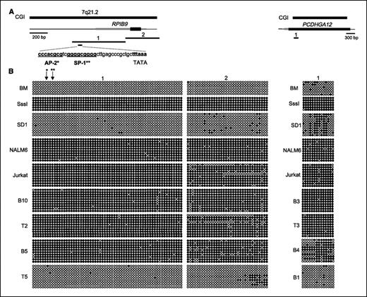 Figure 3. Methylation maps of RPIB9/ABCB1 and PCDHGA12. A, genomic region encompassed by differentially methylated CGI. Left, the CGI encompassing the predicted promoter, first exon, and a portion of the first intron of RPIB9 (this region is also contained within the first intron of ABCB1); right, the CGI located solely within the first exon of PCDHGA12. The CGI is indicated at the top of each image with a heavy black line. Next is a depiction of exon 1 for both genes with the 5′-untranslated region (thinner gray box) and the coding portion of exon 1 (thicker black box). The thin line represents genomic sequence upstream and downstream of exon 1 with the scale represented with a black bar and 200 bp (RPIB9) and 300 bp (PCDHGA12). The thick numbered black lines below each gene represent the genomic regions for which we collected bisulfite sequencing data. Two regions were sequenced from the RPIB9/ABCB1 CGI and one region was sequenced from the PCDHGA12 CGI. The small black line below RPIB9 fragment one represents the location of the predicted promoter sequence with AP2, SP1, and TATA binding motifs indicated in bold letters. B, bisulfite genomic sequencing. One normal bone marrow sample, one SssI-treated normal PBL DNA sample, three ALL cell lines (SD1, NALM6, and Jurkat), and four primary tumor DNA samples (RPIB9: B5, B10, T2, and T5; PCDHGA12: B1, B3, B4, and T3) were bisulfite converted and sequenced for two regions in RPIB9/ABCB1 and one region in PCDHGA12. Primary tumor samples beginning with a B are from patients with B-cell ALL and primary tumor samples beginning with a T are from patients with T-cell ALL. Cytosines present within the AP2 (*, arrow) and SP1 (**, arrow) transcription factor binding sites.