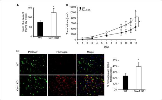 Figure 1. Tumors implanted into Cav KO mice have increased tumor microvascular permeability and growth. A, 106 LLC cells were implanted s.c. in the lower back of 6- to 8-wk-old male WT or KO mice. Mice with tumor sizes between 1,000 and 2,500 mm3 were used to measure vascular permeability by Evans blue extravasation (30 mg/kg, i.v.; 30 min) as an index of albumin leakage. Evans blue was extracted in formamide at 55°C for 24 h and quantified spectrophotometrically at 630 nm. Note the increase in tumor microvascular permeability in Cav KO mice. *, P < 0.05, compared with Cav WT by Student's t test (n = 12 for WT and n = 16 for KO). B, to characterize the hyperpermeable phenotype of tumors implanted into Cav-1 KO mice, LLC implanted s.c. in WT or KO mice were excised at day 14 (end point tumor) and fixed in 3% paraformaldehyde. Frozen sections (5 μm) of the tumor tissue were double immunofluorescently labeled for blood vessels (PECAM-1, green) and fibrinogen (red). The sections were counterstained with DAPI for nuclear labeling (blue). The percentage of fibrinogen and PECAM-1 colocalization (yellow) was quantified and normalized to total PECAM-1–positive pixel density. Columns, mean; bars, SE. *, P < 0.05 compared with WT by Student's t test (n = 6 for WT and n = 5 for KO). C, to monitor the effect of hyperpermeability on tumor progression, LLC cells were implanted in WT or KO mice similar to those in (A) and when tumors become palpable, tumor size was monitored every 2 d using a caliper and allowed to progress for 12 d. Tumors implanted in the Cav-1 (−/−) mice exhibited increased tumor progression. *, P < 0.001, compared with WT by two-way ANOVA (n = 5 for WT and n = 8 for KO); *, P < 0.05 using Bonferroni post hoc test at day 12. Representative of two separate experiments. Bar, 100 μm.