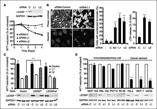 Figure 3. Depletion of LEDGF induces apoptosislike cell death in cancer cells. A, HeLa cells transfected with control siRNA or two nonoverlapping siRNAs against LEDGF (L1 and L2) were analyzed for the expression of LEDGF and GAPDH by immunoblotting 72 h posttransfection and for cell density by MTT reduction assay 1 to 4 days after the transfection. The data are presented as percentage of MTT reduction in untreated cultures. Points, means of three triplicate experiments; bars, SD. B, HeLa cells were transfected with the indicated siRNAs and analyzed for the plasma membrane integrity by the LDH release assay (72 h) and the apoptosislike nuclear condensation by microscopy (96 h). Columns, means of three (LDH assay) or four (nuclear condensation) independent experiments; bars, SD. Bar, 80 μm (top) and 20 μm (bottom). C, HeLa cells transfected with an empty vector or cDNAs encoding for or wild-type LEDGF (LEDGFwt) or LEDGF with three silent mutations in the sequence corresponding to the LI siRNA sequence (LEDGF*) and the indicated siRNAs were analyzed for cell density by MTT assay 96 h after the plasmid transfection. The data are presented as percentage of MTT reduction in untreated cultures. Columns, means of three triplicate experiments; bars, SD. D, the indicated cell lines were transfected with the control or LEDGF siRNA and analyzed 96 h later for cell density by MTT assay. The data are presented as percentage of MTT reduction in untreated cultures. Columns, means of three triplicate experiments; bars, SD. **, P value <0.01 as compared with cells transfected with either L1 or L2 (A), control siRNA (B and D) or vector (C).