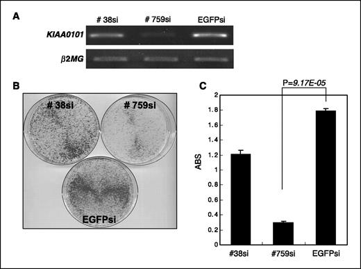 Figure 2. Effect of KIAA0101 knockdown by siRNAs on growth of pancreatic cancer cells. A, either of two siRNA expression vectors specific to KIAA0101 transcript (#38si and #759si) and an EGFP siRNA expression vector (EGFPsi) as a negative control was transfected into KLM-1 cells. Knockdown effect on KIAA0101 transcript was validated by RT-PCR, with β2MG expression as a quantitative control. Transfection with #759si showed significant knockdown effect, whereas #38si or EGFPsi showed no effect on the level of KIAA0101 transcript. B, transfection with #759si vector resulted in drastic reduction of the numbers of viable cells measured by colony formation assay, compared with the cells transfected with either of other siRNA expression vectors that showed no knockdown effect on KIAA0101 expression. C, transfection with #759si vector resulted in drastic reduction of the numbers of viable cells measured by MTT assay. Y-axis, absorbance (ABS) at 490 nm (MTT assay), and at 630 nm as reference, measured with a microplate reader (P = 9.17e−5, Student's t test).